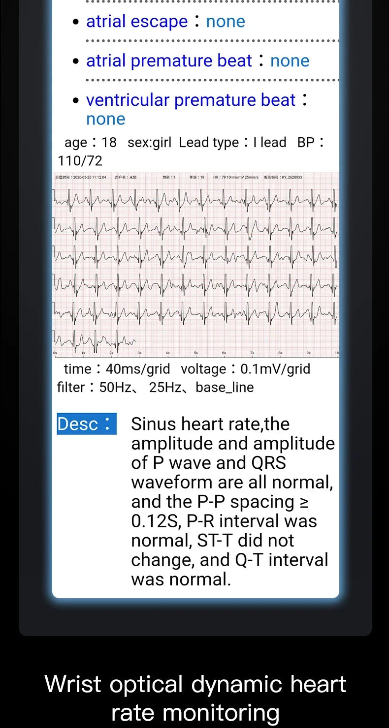 Smartwatch EKG intelligens csuklópánt vízálló P11 Plus intelligens karkötő aktivitáskövető vér oxigén intelligens karkötő fitnesz karkötő