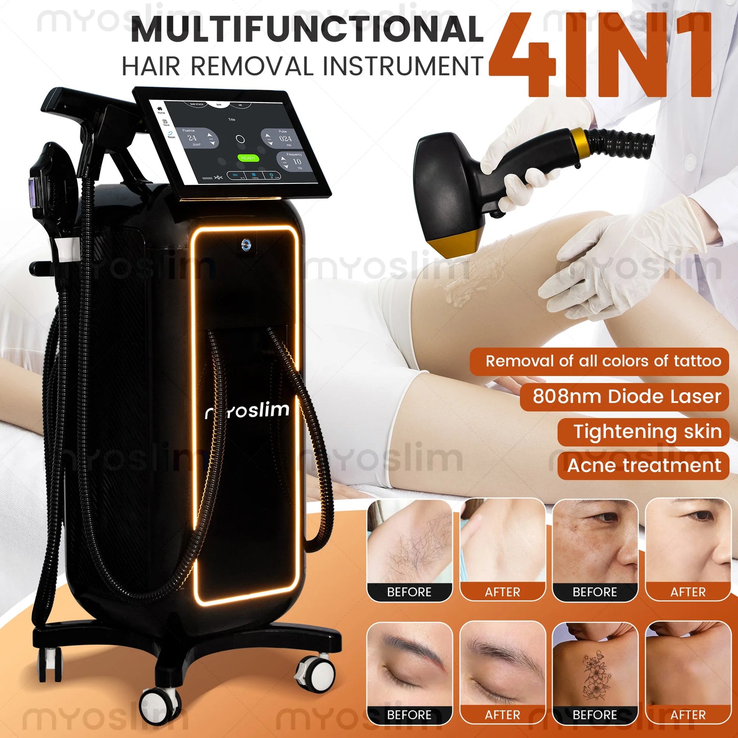 Soprano Titanium Ice 4 IN1 Platinum RF Dióda 755NM 808NM 940NM 1064nm 4 Hullámú Lézer ND:YAG Gép Fájdalommentes Szőrtelenítő Gép